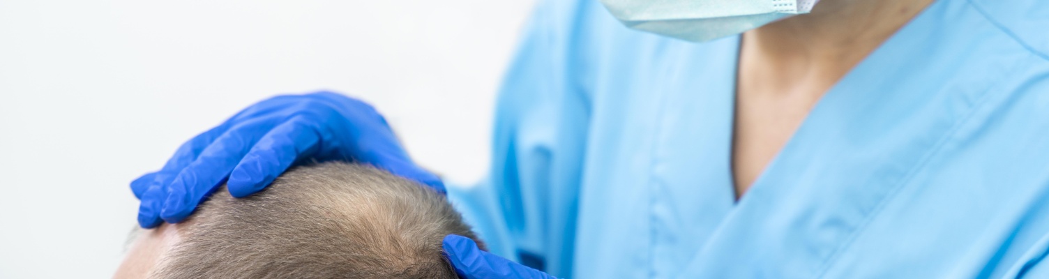 How to prevent hair loss